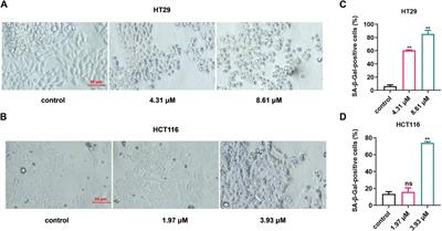 Systematic bioinformatics analysis reveals the role of shikonin in blocking colon cancer progression by identifying senescence-induced genes